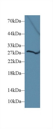 Western blot - Anti-Dio3 antibody (AB233035), expandable thumbnail