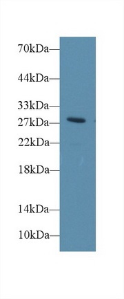 Western blot - Anti-Dio3 antibody (AB233035), expandable thumbnail