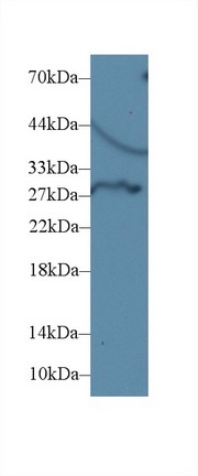 Western blot - Anti-Dio3 antibody (AB233035), expandable thumbnail