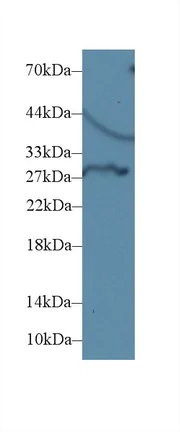 Western blot - Anti-Dio3 antibody (AB233035)