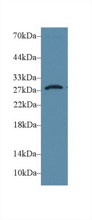 Western blot - Anti-Dio3 antibody (AB233035), expandable thumbnail