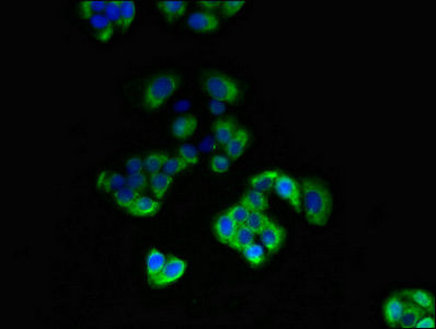Immunocytochemistry/ Immunofluorescence - Anti-Dio3 antibody (AB234770)