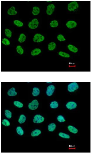 Immunocytochemistry/ Immunofluorescence - Anti-DIP13B/APPL2 antibody (AB154661)