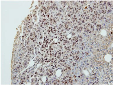 Immunohistochemistry (Formalin/PFA-fixed paraffin-embedded sections) - Anti-DIP13B/APPL2 antibody (AB154661)
