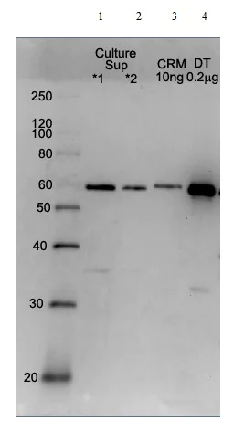 Western blot - Anti-Diphtheria Toxin antibody (AB151222)