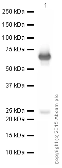 Western blot - Anti-Diphtheria Toxin antibody [IGX3492] (AB209329)