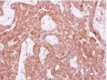 Immunohistochemistry (Formalin/PFA-fixed paraffin-embedded sections) - Anti-DIPP antibody (AB126962)