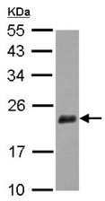Western blot - Anti-DIPP antibody (AB126962)
