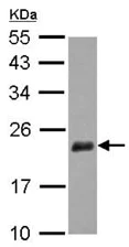 Western blot - Anti-DIPP antibody (AB126962)