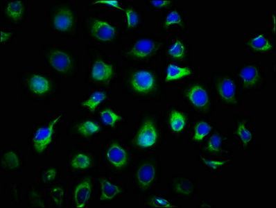 Immunocytochemistry/ Immunofluorescence - Anti-DIRAS1 antibody (AB238491), expandable thumbnail