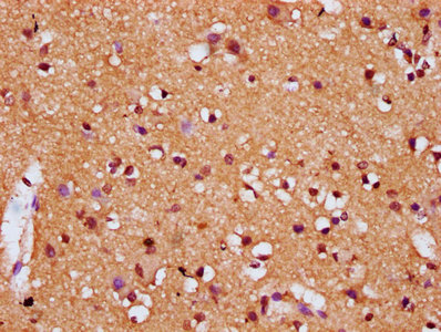 Immunohistochemistry (Formalin/PFA-fixed paraffin-embedded sections) - Anti-DIRAS1 antibody (AB238491), expandable thumbnail