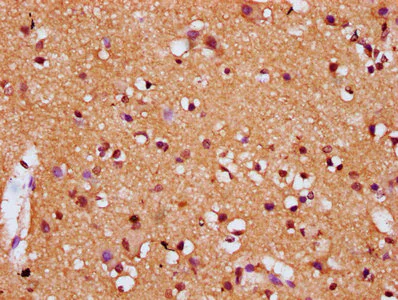 Immunohistochemistry (Formalin/PFA-fixed paraffin-embedded sections) - Anti-DIRAS1 antibody (AB238491)