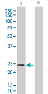 Western blot - Anti-DIRAS2 antibody (AB67430)