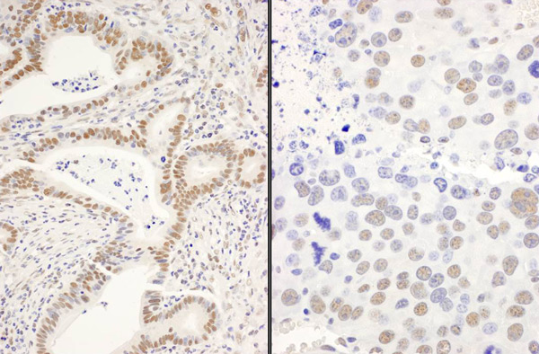 Immunohistochemistry (Formalin/PFA-fixed paraffin-embedded sections) - Anti-DIS antibody (AB70243)