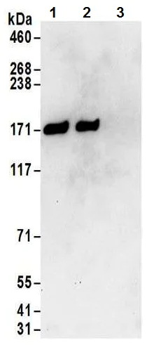 Immunoprecipitation - Anti-DIS antibody (AB70243)