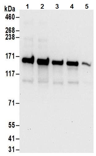 Western blot - Anti-DIS antibody (AB70243)