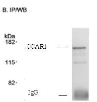 Immunoprecipitation - Anti-DIS antibody (AB70245)
