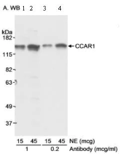 Western blot - Anti-DIS antibody (AB70245)