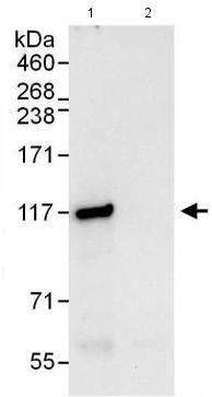 Immunoprecipitation - Anti-DIS3 antibody (AB176802)