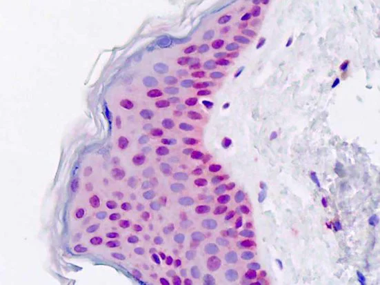 Immunohistochemistry (Formalin/PFA-fixed paraffin-embedded sections) - Anti-DIS3 antibody (AB179933)