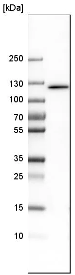 Western blot - Anti-DIS3 antibody (AB223767)