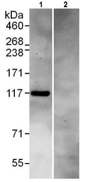 Immunoprecipitation - Anti-DIS3 antibody (AB226186)