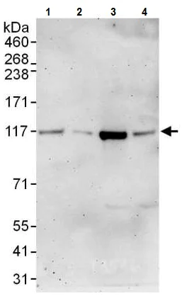 Western blot - Anti-DIS3 antibody (AB226186)