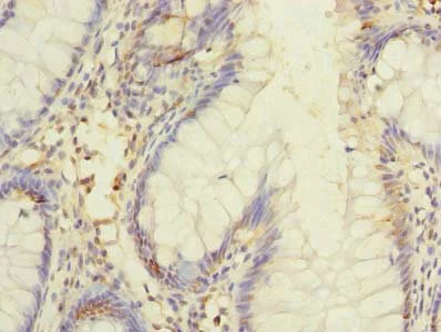 Immunohistochemistry (Formalin/PFA-fixed paraffin-embedded sections) - Anti-DIS3L antibody (AB235532)