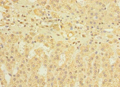Immunohistochemistry (Formalin/PFA-fixed paraffin-embedded sections) - Anti-DIS3L antibody (AB235532)