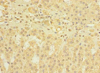 Immunohistochemistry (Formalin/PFA-fixed paraffin-embedded sections) - Anti-DIS3L antibody (AB235532)