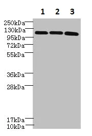 Western blot - Anti-DIS3L antibody (AB235532)