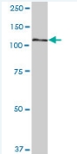 Western blot - Anti-DIS3L antibody (AB89042)