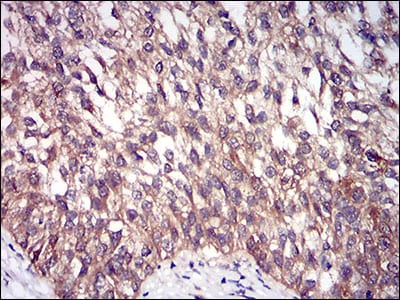Immunohistochemistry (Formalin/PFA-fixed paraffin-embedded sections) - Anti-DIS3L2 antibody [6C7B2] (AB181743)