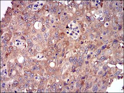 Immunohistochemistry (Formalin/PFA-fixed paraffin-embedded sections) - Anti-DIS3L2 antibody [6C7B2] (AB181743)