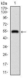 Western blot - Anti-DIS3L2 antibody [6C7B2] (AB181743)