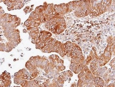 Immunohistochemistry (Formalin/PFA-fixed paraffin-embedded sections) - Anti-Dishevelled 2 antibody (AB137528)