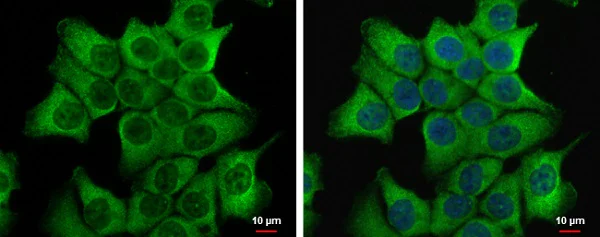 Immunocytochemistry/ Immunofluorescence - Anti-Dishevelled 2 antibody (AB228804)