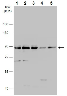 Western blot - Anti-Dishevelled 2 antibody (AB228804)
