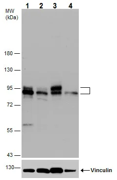 Western blot - Anti-Dishevelled 2 antibody (AB228804)