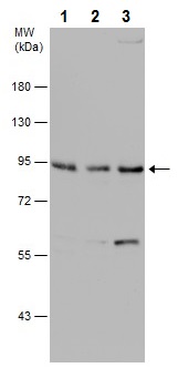 Western blot - Anti-Dishevelled 2 antibody (AB228804)