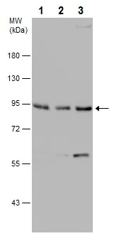 Western blot - Anti-Dishevelled 2 antibody (AB228804)