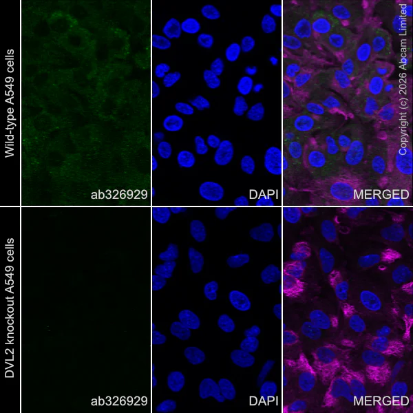 Immunocytochemistry/ Immunofluorescence - Anti-Dishevelled 2 antibody [EPR30298-73] (AB326929)