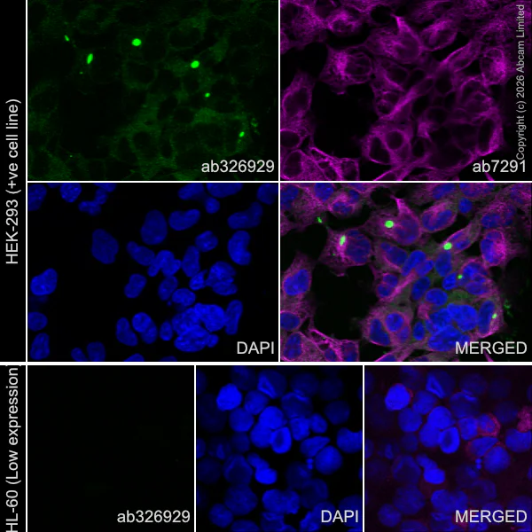 Immunocytochemistry/ Immunofluorescence - Anti-Dishevelled 2 antibody [EPR30298-73] (AB326929)