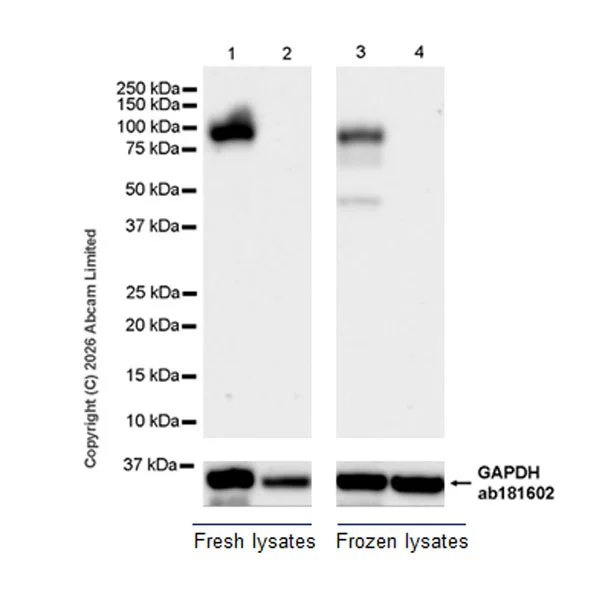 Western blot - Anti-Dishevelled 2 antibody [EPR30298-73] (AB326929)