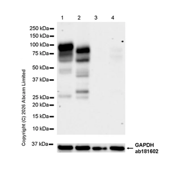 Western blot - Anti-Dishevelled 2 antibody [EPR30298-73] (AB326929)