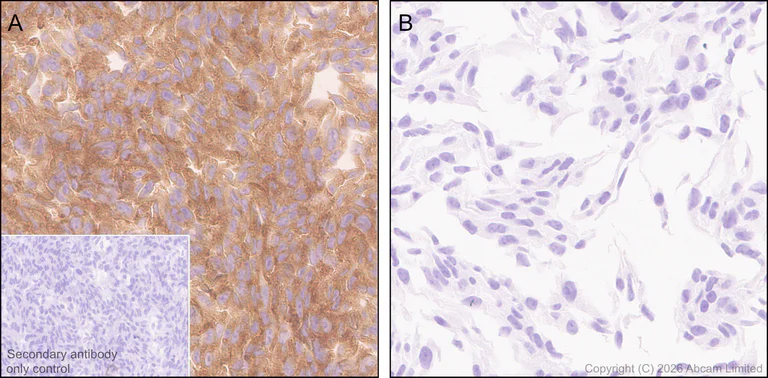 Immunohistochemistry (Formalin/PFA-fixed paraffin-embedded sections) - Anti-Dishevelled 2 antibody [EPR30298-74] - BSA and Azide free (AB325945)