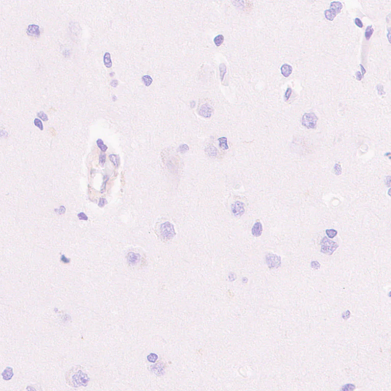 Immunohistochemistry (Formalin/PFA-fixed paraffin-embedded sections) - Anti-Dishevelled 2 antibody [EPR30298-74] - BSA and Azide free (AB325945)