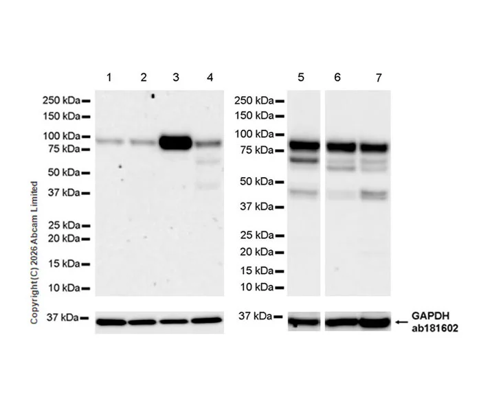 Western blot - Anti-Dishevelled 2 antibody [EPR30298-74] - BSA and Azide free (AB325945)