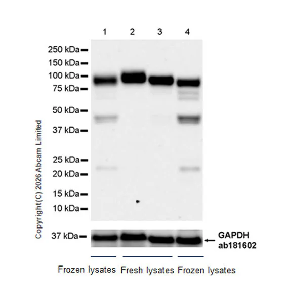 Western blot - Anti-Dishevelled 2 antibody [EPR30298-74] - BSA and Azide free (AB325945)