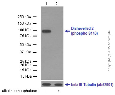 Western blot - Anti-Dishevelled 2 (phospho S143) antibody [EPNCIR145] (AB124933)